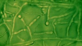 Second hookworm genome hoped to lead to vaccines