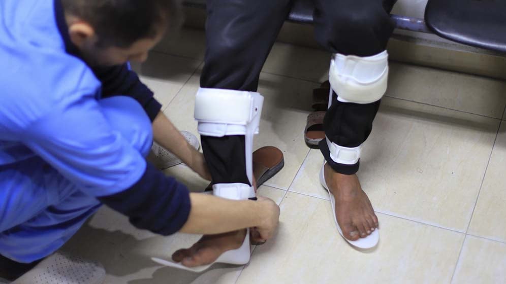 ALPC Orthosis