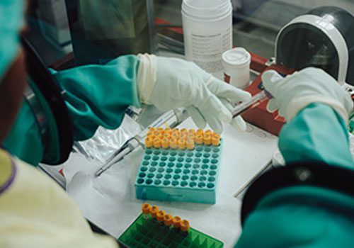 An MSF staff member analyses blood samples at the Elikya Ebola Treatment Centre (ETC) in Bunia. Democratic Republic of Congo 2026