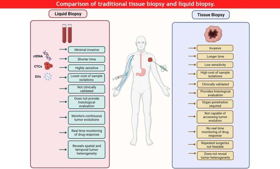 Comparison of traditional tissue biopsy and liquid biopsy. The schematic illustrates the advantages that liquid biopsies have gained over traditional invasive surgical methods