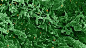 Monkeypox decision a shot in the arm for African health