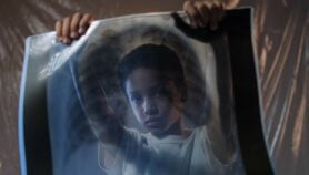 Algorithm could hold key to child TB diagnosis