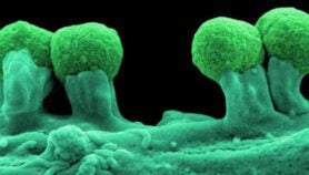 Antimicrobials used on farms ‘weaken human immunity’