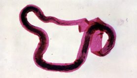 Treating elephantiasis cuts HIV risk in Tanzania