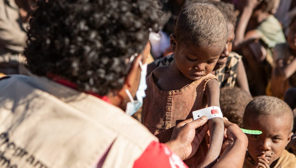 Madascar malnutrition