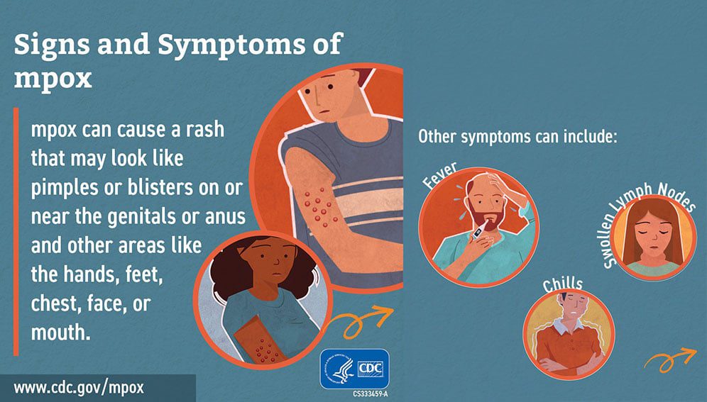 mpox symptoms by CDC
