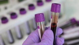 Why African men should get tested for prostate cancer