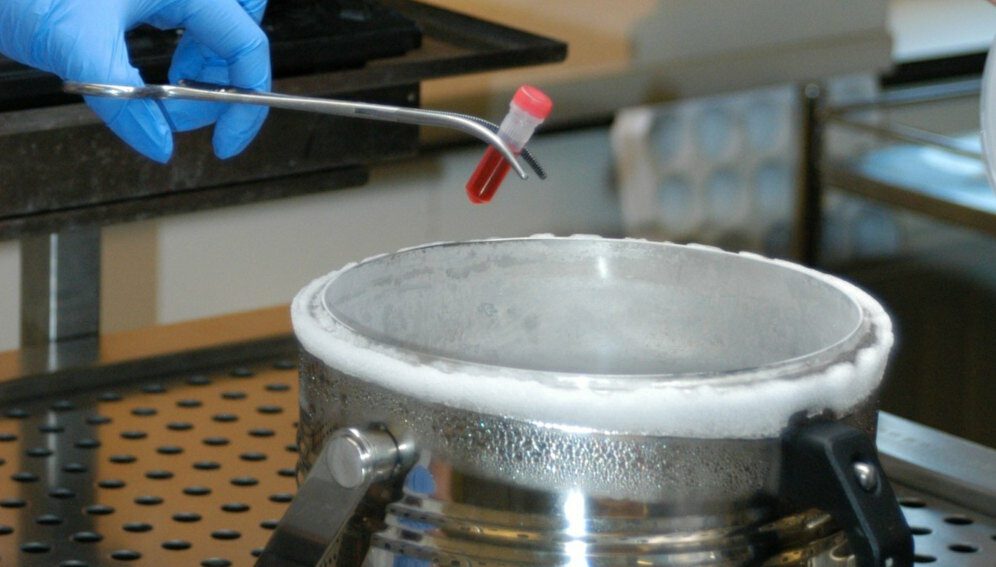 Biospecimen in Biobank