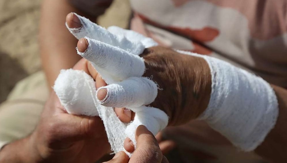 Iraqi members with the Emergency Relief Battalion, Iraqi army, practice bandaging burns on a simulated casualty during combat lifesaver training at Al Taqaddum, Iraq, March 31, 2018. This training is part of the overall Combined Joint Task Force – Operation Inherent Resolve enhanced partner capacity mission which focuses on improving security capabilities within the nation. (U.S. Army photo by Spc. Shannon Westpfahl)