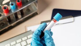 New blood test speeds childhood cancer diagnosis